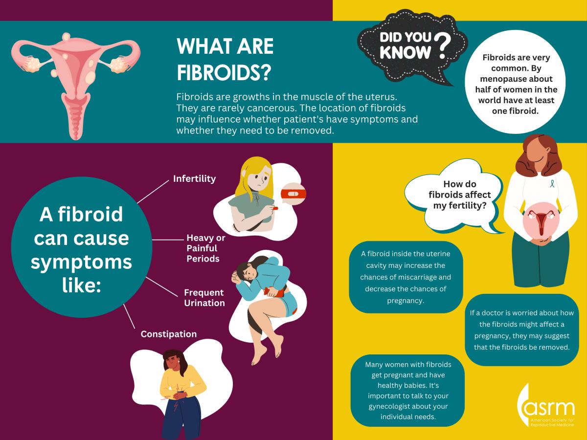 Symptoms of Uterine Fibroids