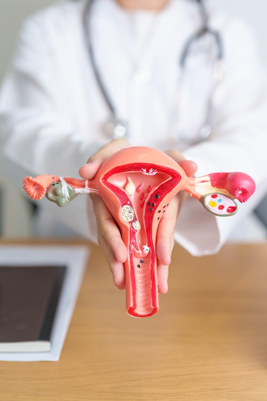 A Complete Guide to Endometriosis: Symptoms, Treatments, and the Role of Laparoscopic Surgery
